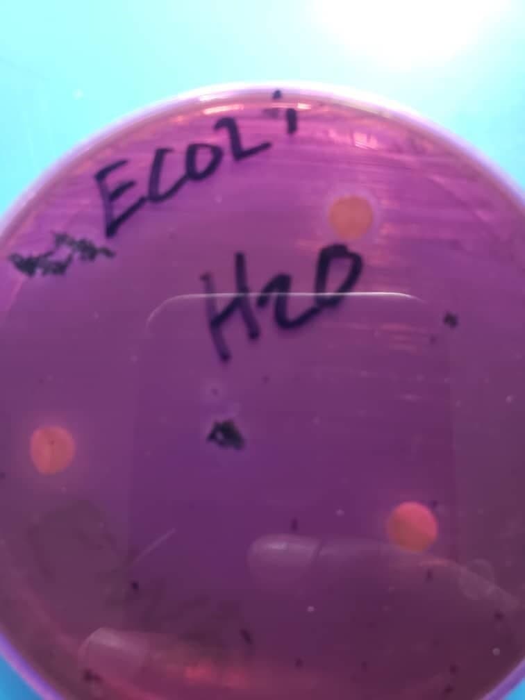 Figure 2. Shows the zones of inhibition of E. Coli.