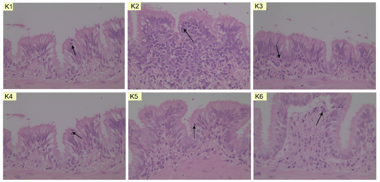Figure 5. Microscopic image of mast cells in (KN) normal group, (K2) negative group, (K3) salbutamol group, (K4) 200 mg/kgBW dose group, (K5) 400 mg/kgBW dose group, and (K6) 800 mg/kgBW dose group.