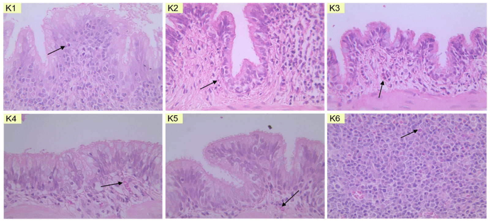 Figure 3. Microscopic depiction of eosinophil cells in (K1) normal group, (K2) negative group, (K3) salbutamol group, (K4) 200 mg/kgBW dose group, (K5) 400 mg/kgBW dose group, and (K6) 800 mg/kgBW dose group of Ciplukan leaf infusion.