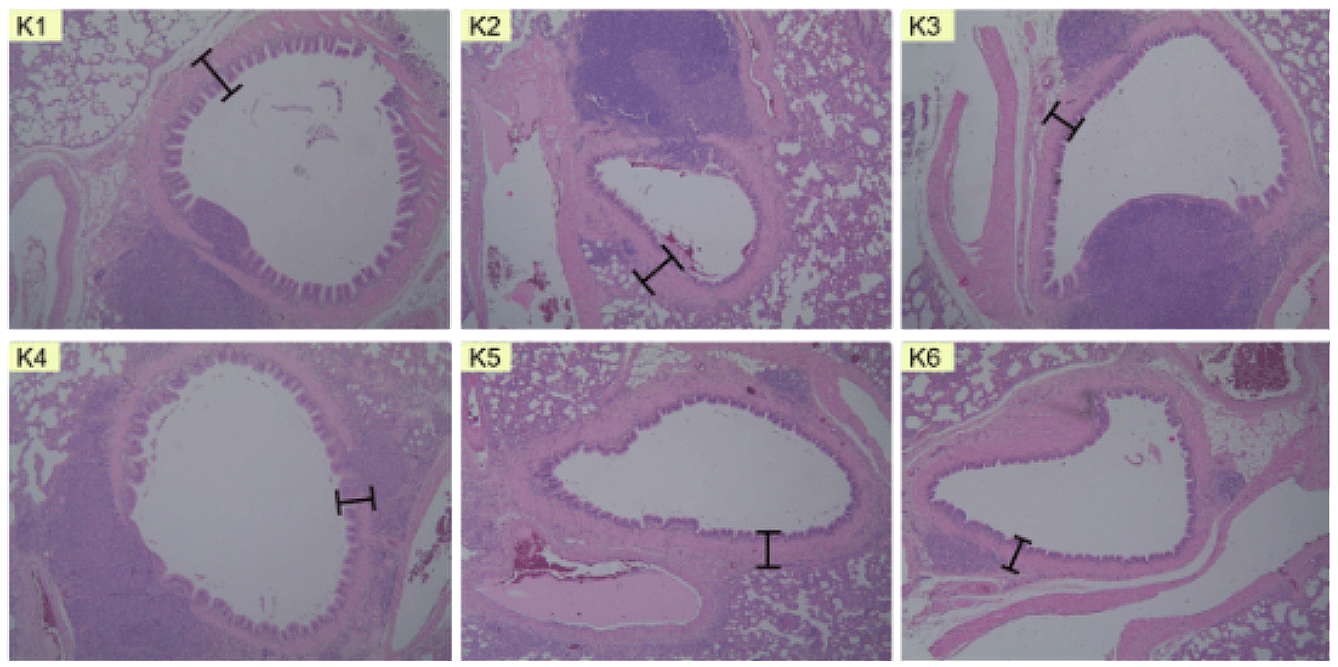 Potential of Ciplukan Leaf (Physalis Angulate L.) Infusion as A Bronchodilator in Pulmonary Histopathology of Sprague Dawley White Rats