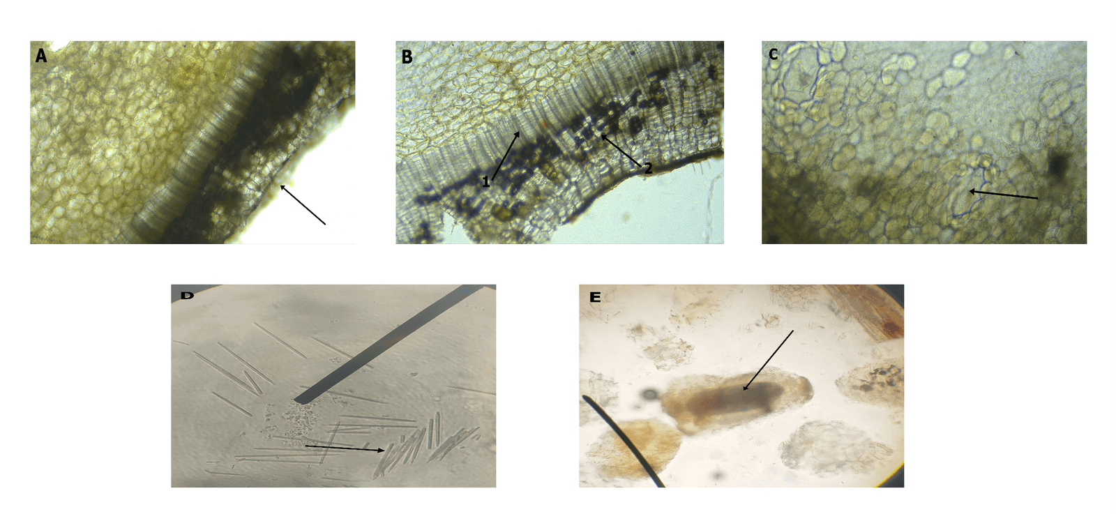 Phenolic Content and Antioxidant Activity of Colocasia esculenta in Commercial Herbal Products
