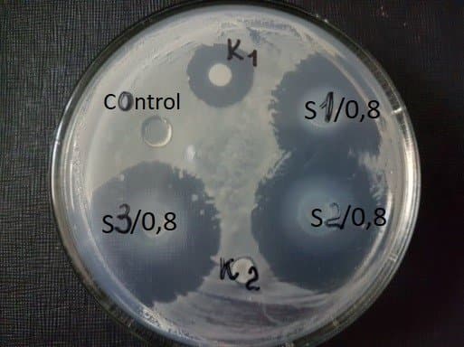 Figure 5. Photos of inhibition zone of hydrogels against Methylophilus quaylei.