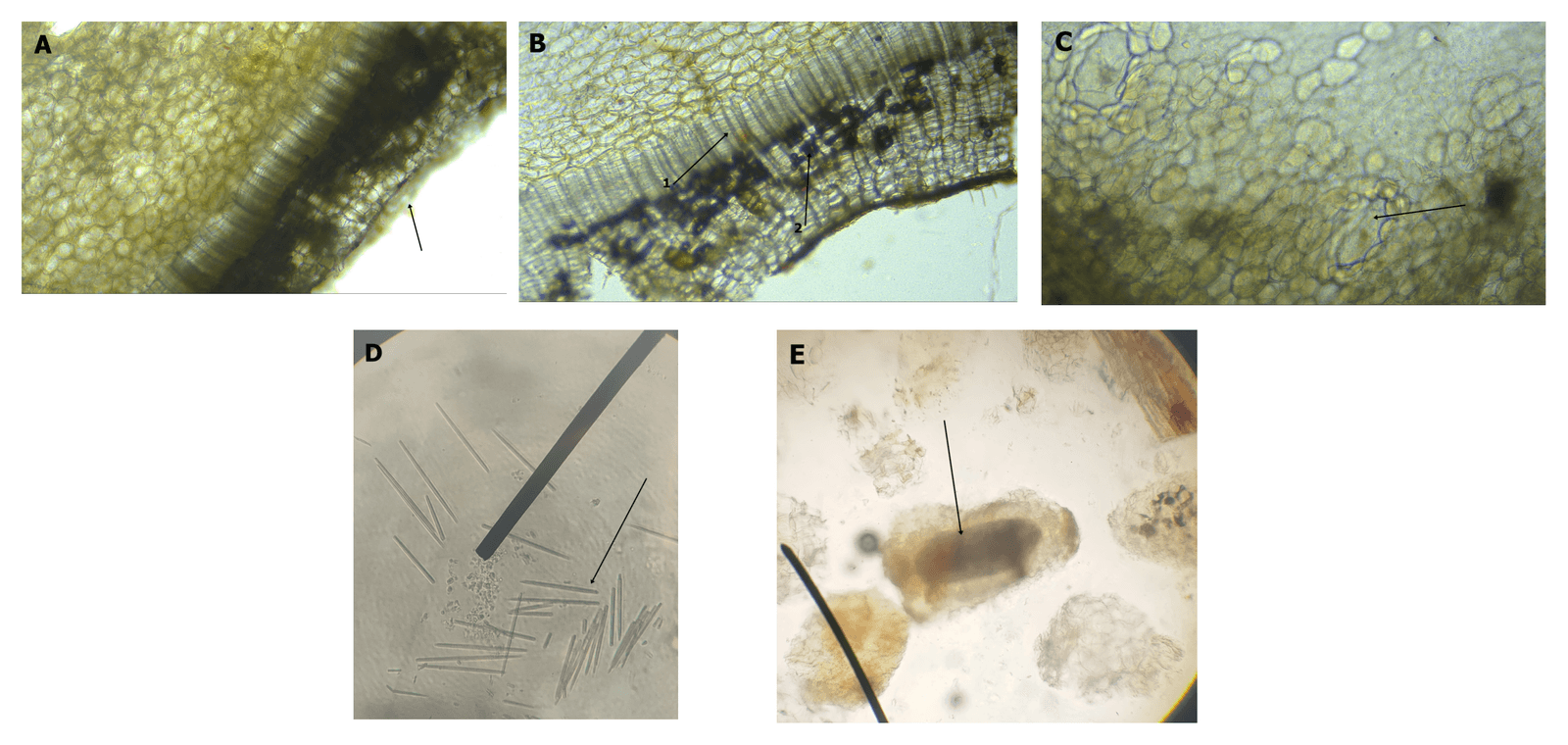 Figure 1. Microscopic sections of the tuber (A-C) and powder (D-E) of Colocasia esculenta. A. Cork cell tissue; D. Needle of calcium oxalate crystals; and E. Idioblasts contain needle crystals of calcium oxalate.