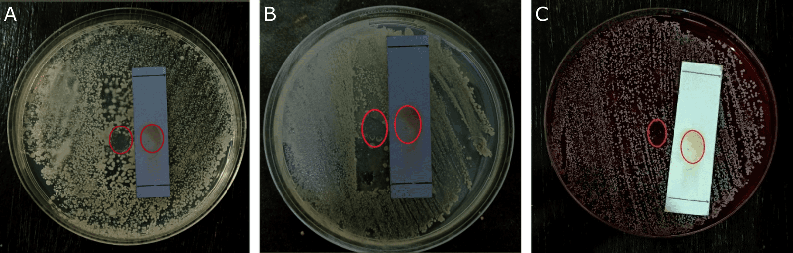 Figure 4. TLC-bioautography of the methanol extract of kecombrang stems showing antibacterial activity against (A) Staphylococcus aureus, (B) Staphylococcus epidermidis, and (C) Propionibacterium acnes.