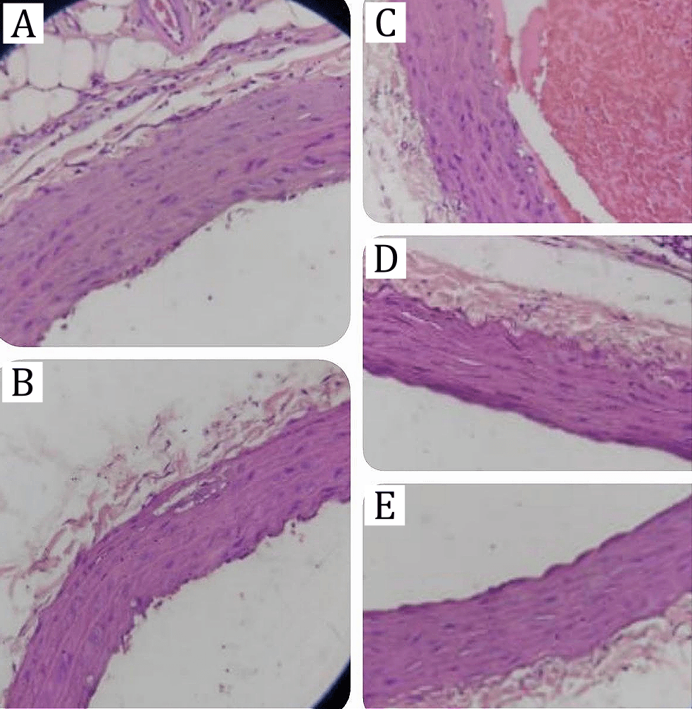 Figure 2. Histopathological analysis of rat aortic tissue (400×, H&E staining). Representative cross-sections of the aorta stained with hematoxylin and eosin (H&E) showing: (A) Normal group, (B) Diseased group, (C) Diseased + simvastatin, (D) Dyslipidemia + FEADSN 100 mg/kg, and (E) Dyslipidemia + FEADSN 150 mg/kg. Scale bar = 50 µm.