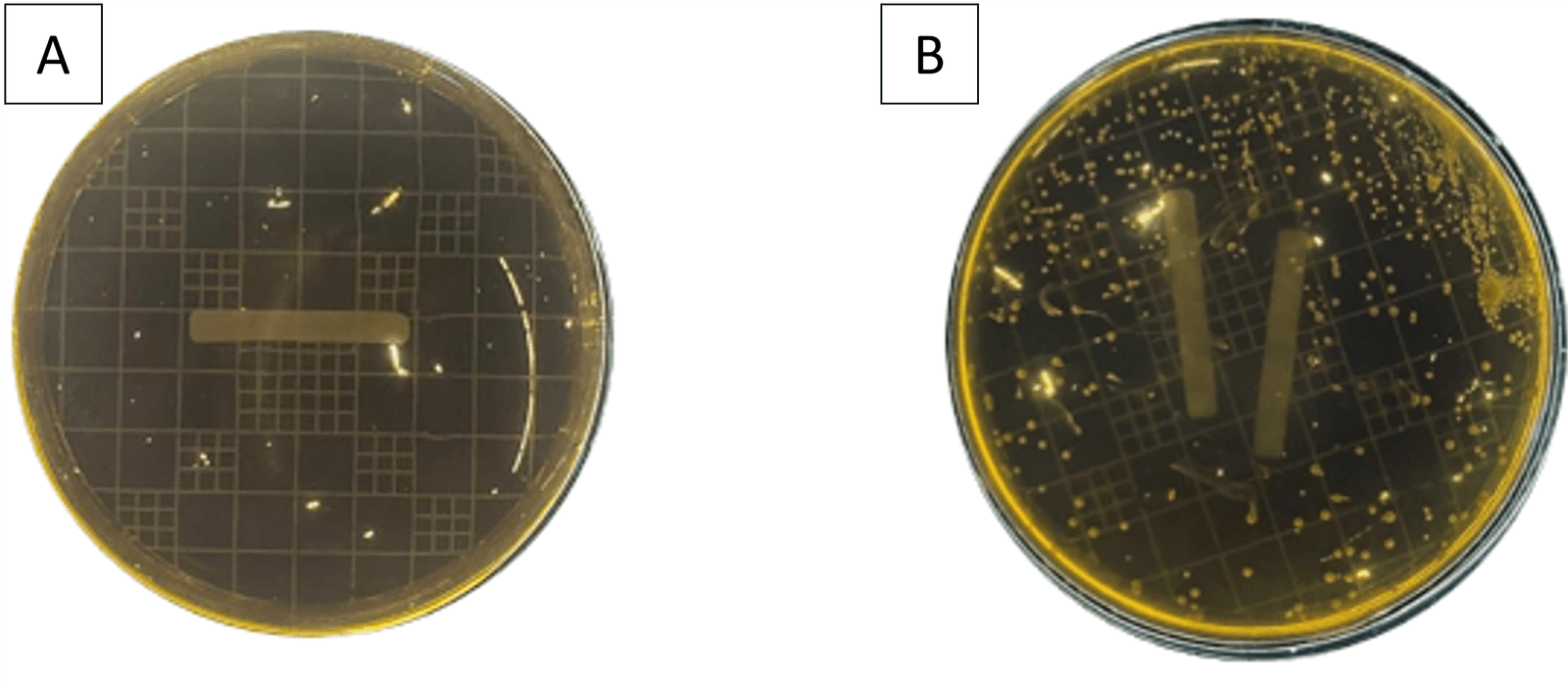 Figure 3. A Control, B Bacterial isolates growing in MRSA medium.