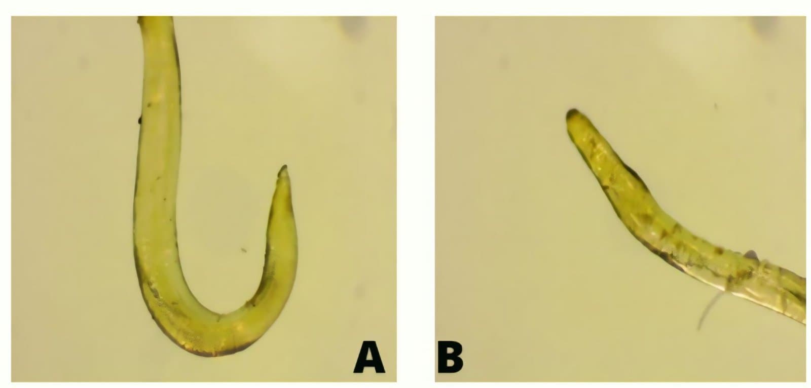 Figure 3. Morphological features of Anisakis sp. Note: (A) anterior and (B) posterior.